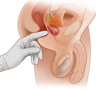 Prostate Massage